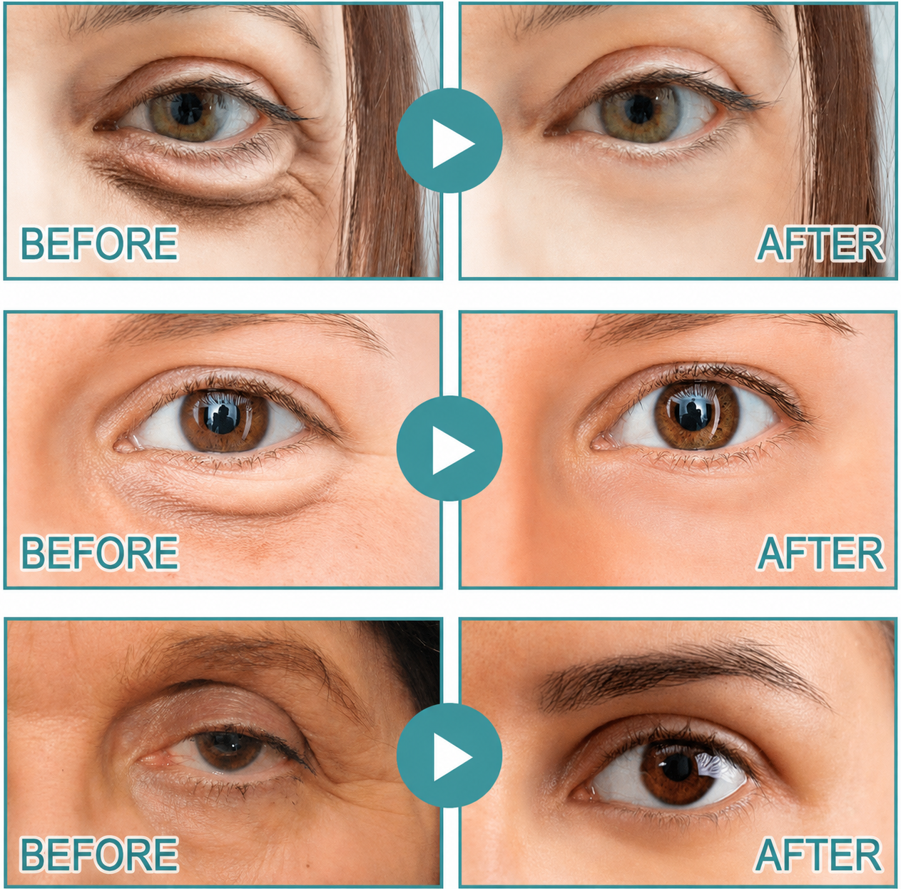 Epidova | Dissolving Microneedle Eye Patches